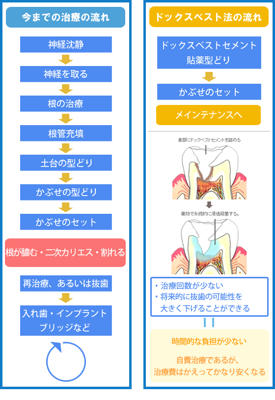 従来の虫歯治療とドックスベスト治療の比較